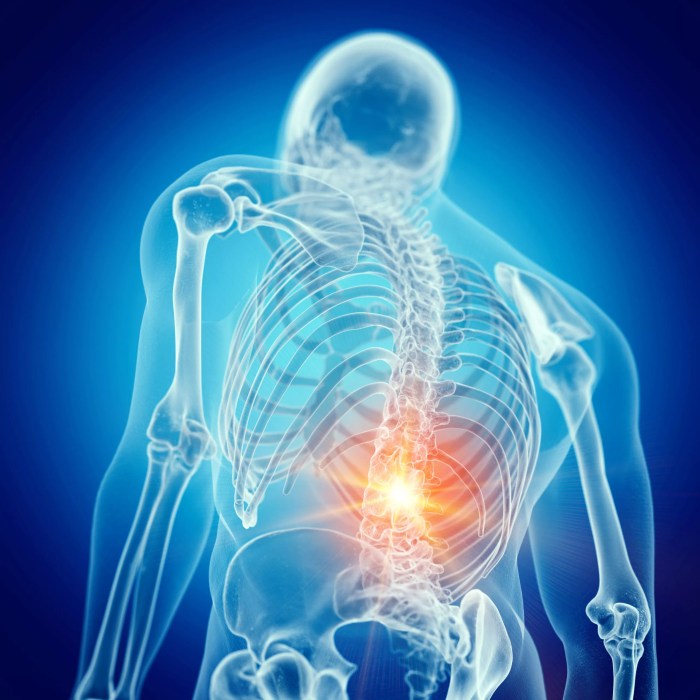 Back pain during pregnancy causes and tips for relief