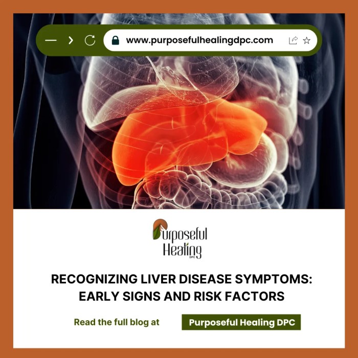 10 warning signs liver diseases