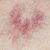 10 Warning Signs Liver Diseases Know the Clues