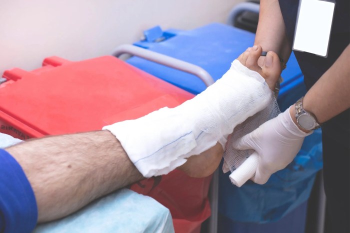 Sulfuric Acid Burns Skin How to burn calories