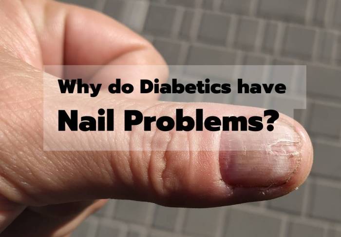 Are your nail problems related your health find out 1 minute